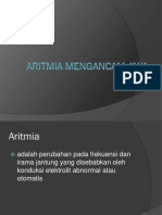 Aritmia Mengancam Jiwa