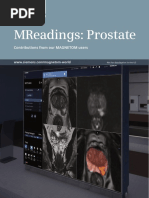 Siemens Mri Magnetom Mreadings Prostate PDF