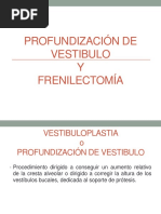 Vestibuloplastia y Frenectomia