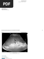 Ecografía Patología Del Bazo