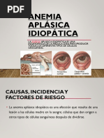 Anemia Aplásica Idiopática