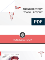 Tonsillectomy