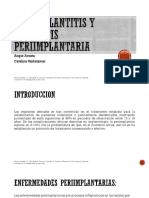 Periimplantitis y Mucositis Periimplantaria