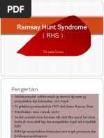 Ramsay Hunt Syndrome