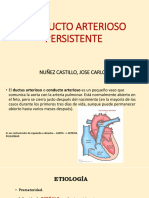 Coartacion de Aorta