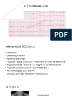 PP VSD-2