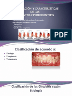 Enfermedad Periodontal