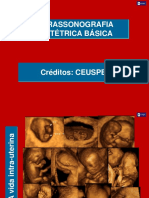 Ultrassonografia em Obstetricia