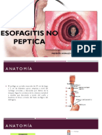 Esofagitis No Peptica