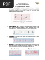 Alteraciones Del Ritmo Cardìaco