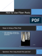 How To Use Fiber Posts