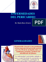 Pericarditis