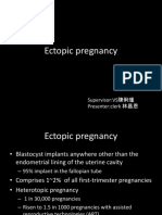 Ectopic Pregnancy William 24th