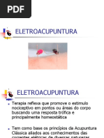 ELETROAção