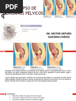 Prolapso de Organos Pelvicos