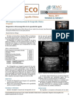 Apendicitis