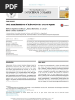 Oral Manifestation Tuberculosis