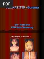 Dermatitis & Eczema 2007