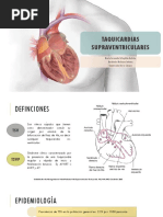 Taquicardias Supraventriculares
