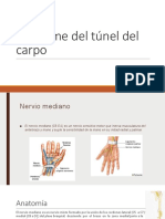 Síndrome Del Túnel Del Carpo