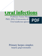 Oral Infections DR Samar