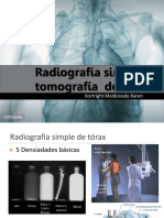 Radiografia Simple y Tomografia de Torax