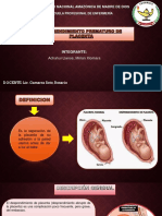 Desprendimiento Prematuro D Placenta