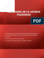 Aneurisma de La Arteria Pulmonar