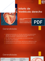 Infarto de Ventriculo Derecho 1