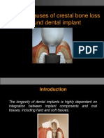 The Early Causes of Crestal Bone Loss Around Dental Implant