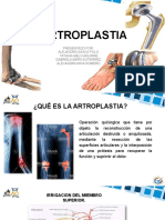 Artroplastia