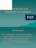 Conventional and Computed Tomography