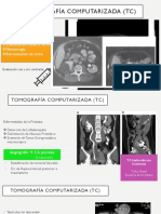 Tomografía Computarizada-Urología