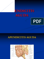 Apendicitis Aguda