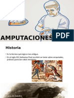 Amputaciones