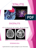 ENCEFALITIS