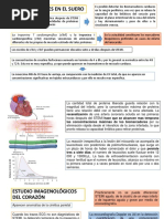 Biomarcadores de Infarto Agudo de Miocardio Con Elevacion ST