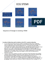 Ecg Stemi: Sequence of Changes in Evolving STEMI