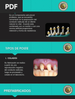 Tipos de Postes