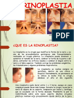 RINOPLASTIA