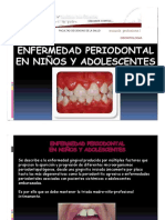 Enfermedad Periodontal en Niños y Adolescentes