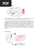 VF: in Vitro Fertilization