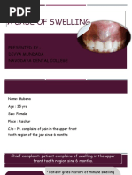 A Case of Swelling: Presented by - Divya Mundada Navodaya Dental College