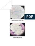 Result:: Staphylococcus Aureus, S.aureus (100x)