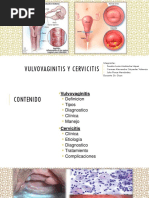 Vulvovaginitis y Cervicitis