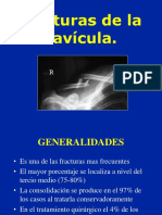 02-Clavicula Fractura