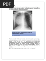 Casos Clinicos Neumonia