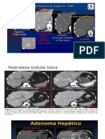 Tomografia Patologias