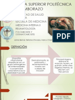 Polimiositis 2