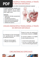 Apendicitis